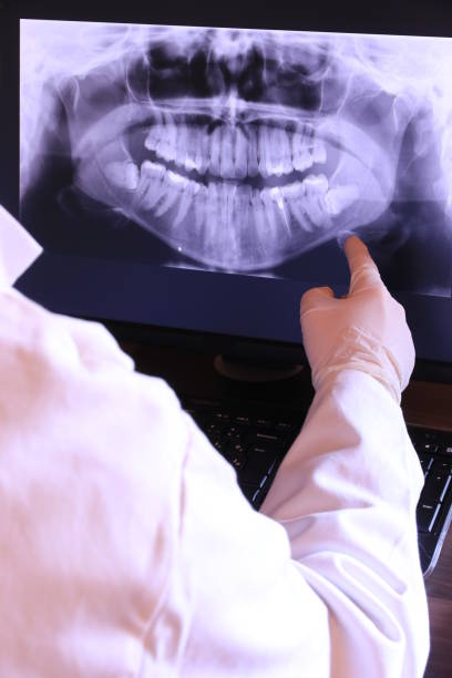Best Emergency Dental Care for Broken or Chipped Teeth in Kosciusko, MS