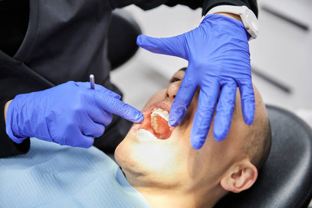 Best Emergency Tooth Extraction in Kosciusko, MS