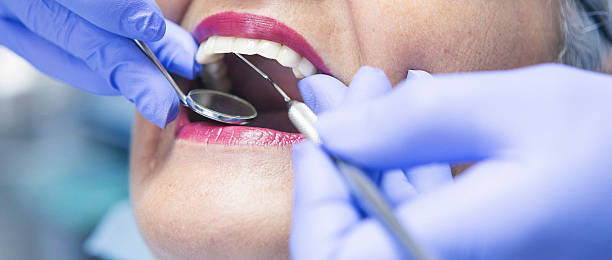 Best Emergency Tooth Extraction in Kosciusko, MS